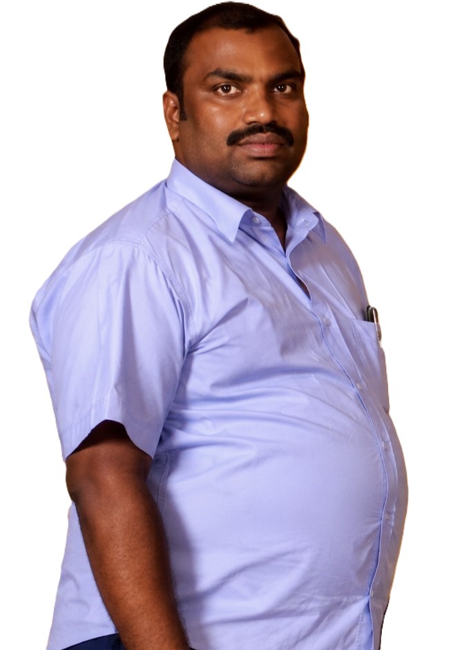 Before weight loss and body contouring treatment at Dexa Clinic